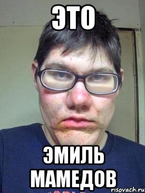 Эмиль лох