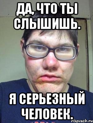 Да я слышал