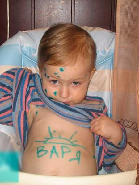 Симпсоны ветряночная вечеринка