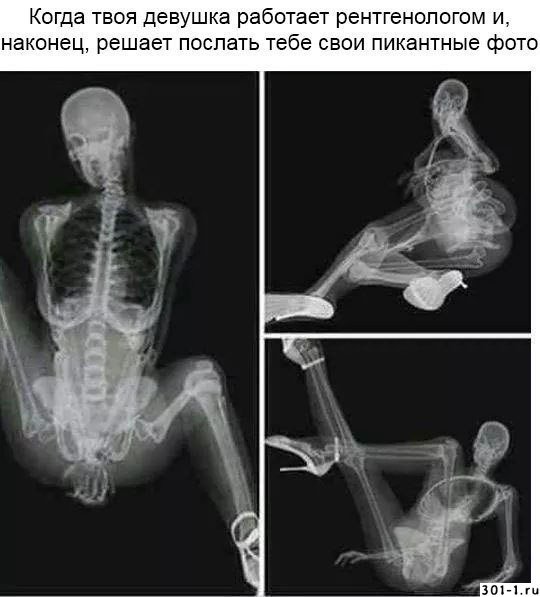 Смешной рентген
