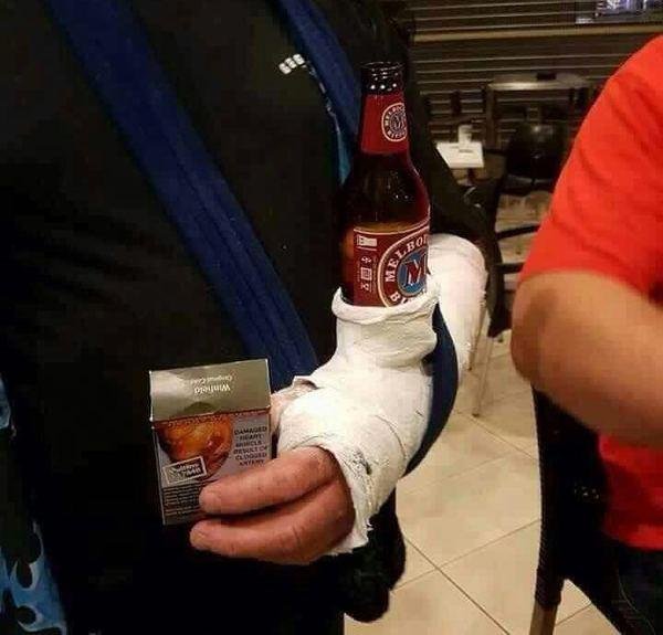 Анекдот про сломанную ногу