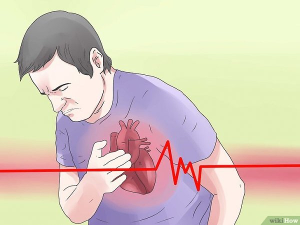 Сердечный приступ рисунок