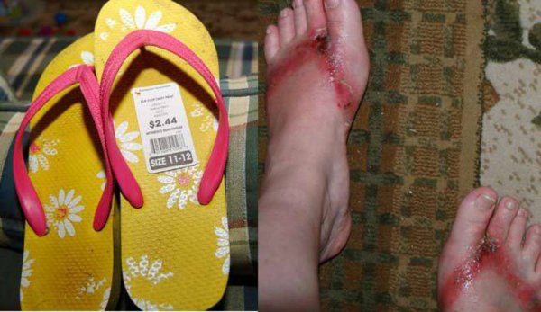 Шлепанцы прикольные с пальцами