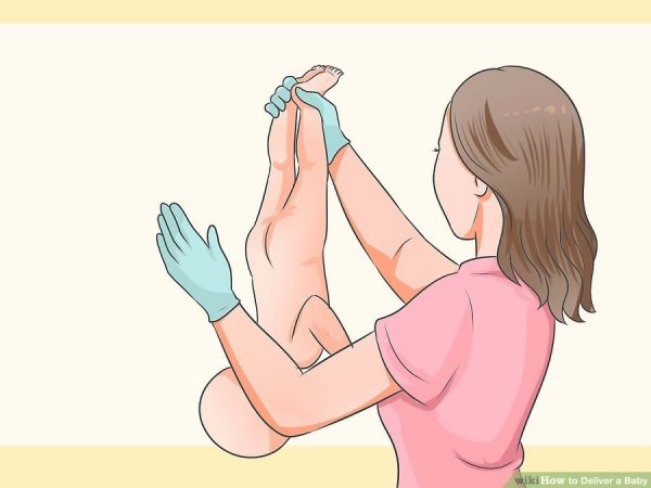 Медсестра шлепает ребенка