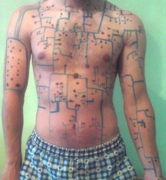 Ветрянка картинка прикольная