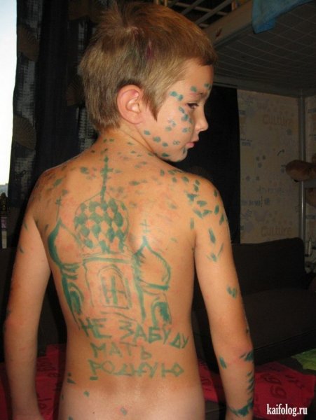 Человек весь в зеленке