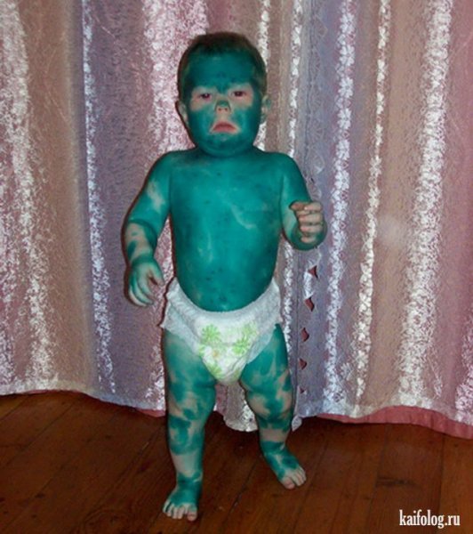 Человек весь в зеленке