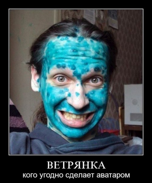 Ветрянка картинка прикольная