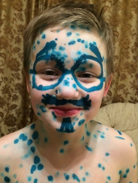 Ребенок с коленками в зеленке