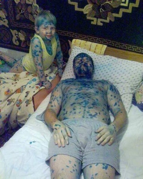 Дети в зеленке Черепашки ниндзя