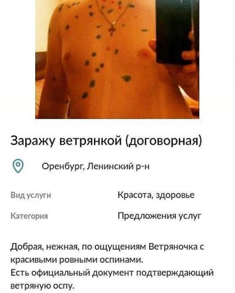 Агравированная ветрянка