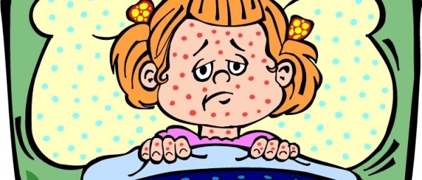 Ветрянка ветряная оспа