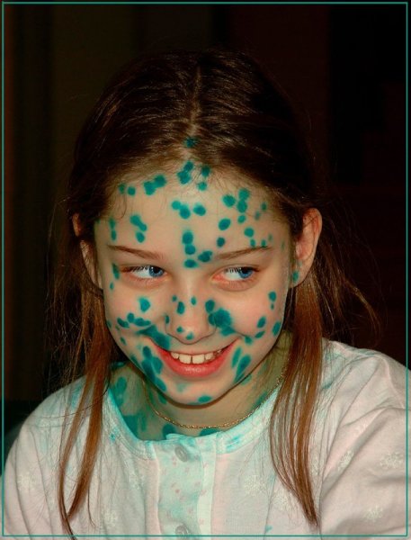 Приколы про ветрянку в картинках