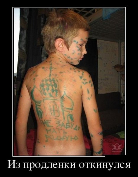 Висцеральная ветрянка