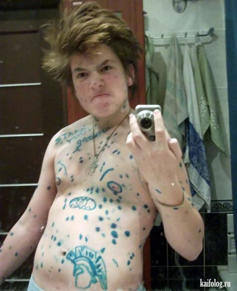 Больной ребенок на прозрачном фоне