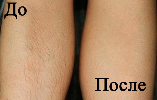 До депиляции приколы