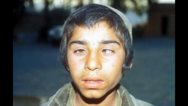 Люди с косыми глазами