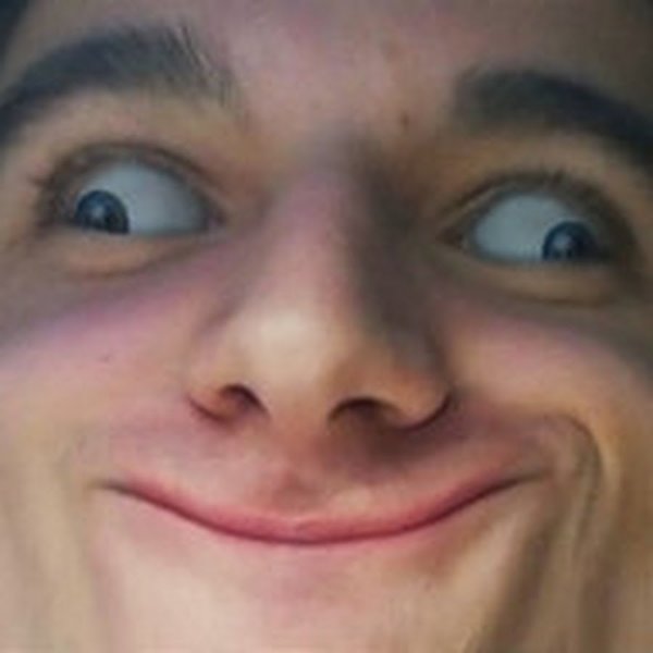 Глазы в разные стороны