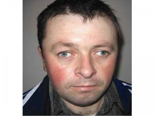 Косоглазие у мужчин