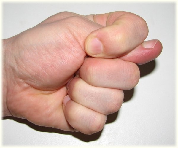 Фига Дуля