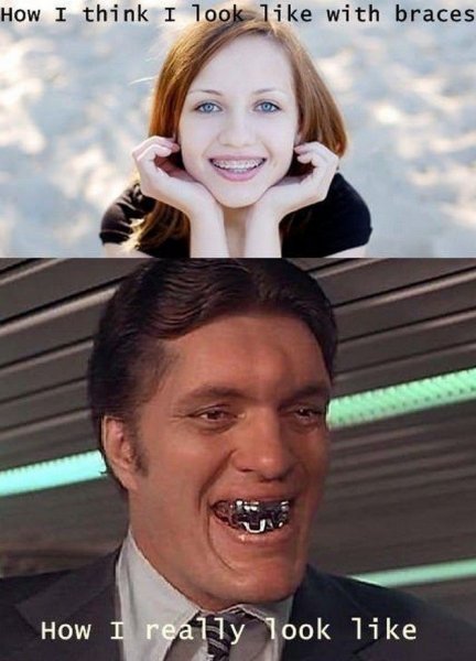 Брекеты рисунок