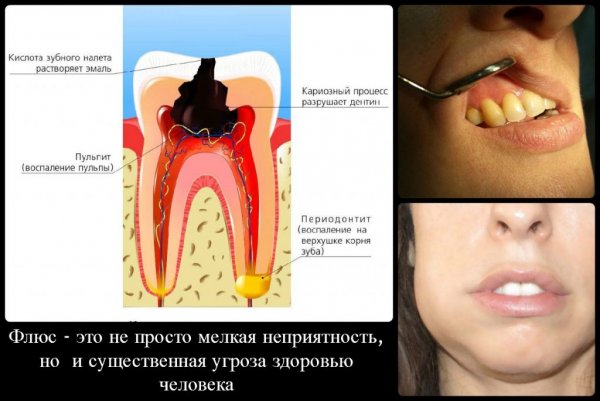 Флюс для алюминия (25мл)