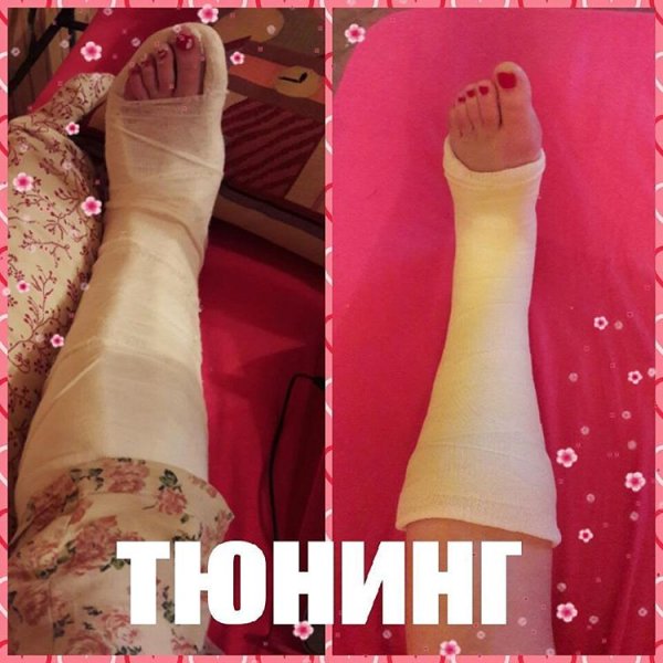 Гипс под пиво