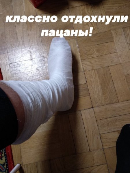 Раскрашенный гипс на руке