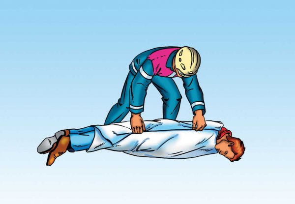 Симптомы при тяжелом отравлении угарным газом