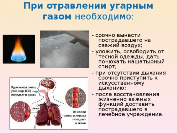 Легкая степень отравления угарным газом