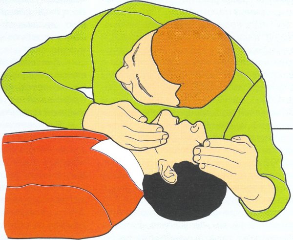 Отравление газом