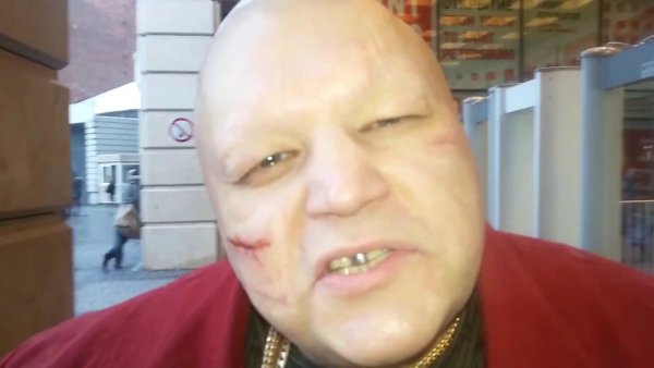 Стас Барецкий плечи