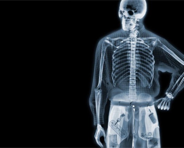 XRAY скелет