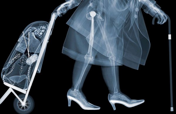 Ник визи. X-ray men