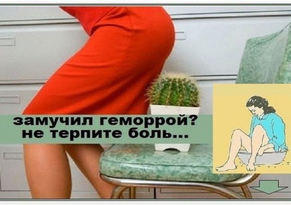 Геморрой карикатура