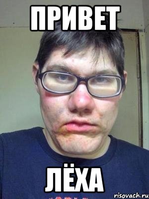 Привет Алексей