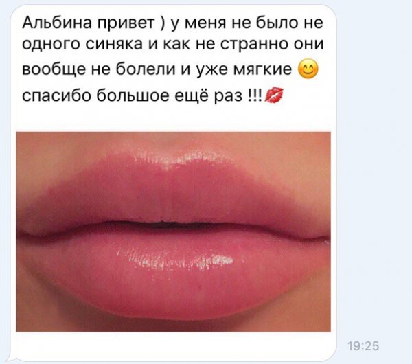 Имя Альбина