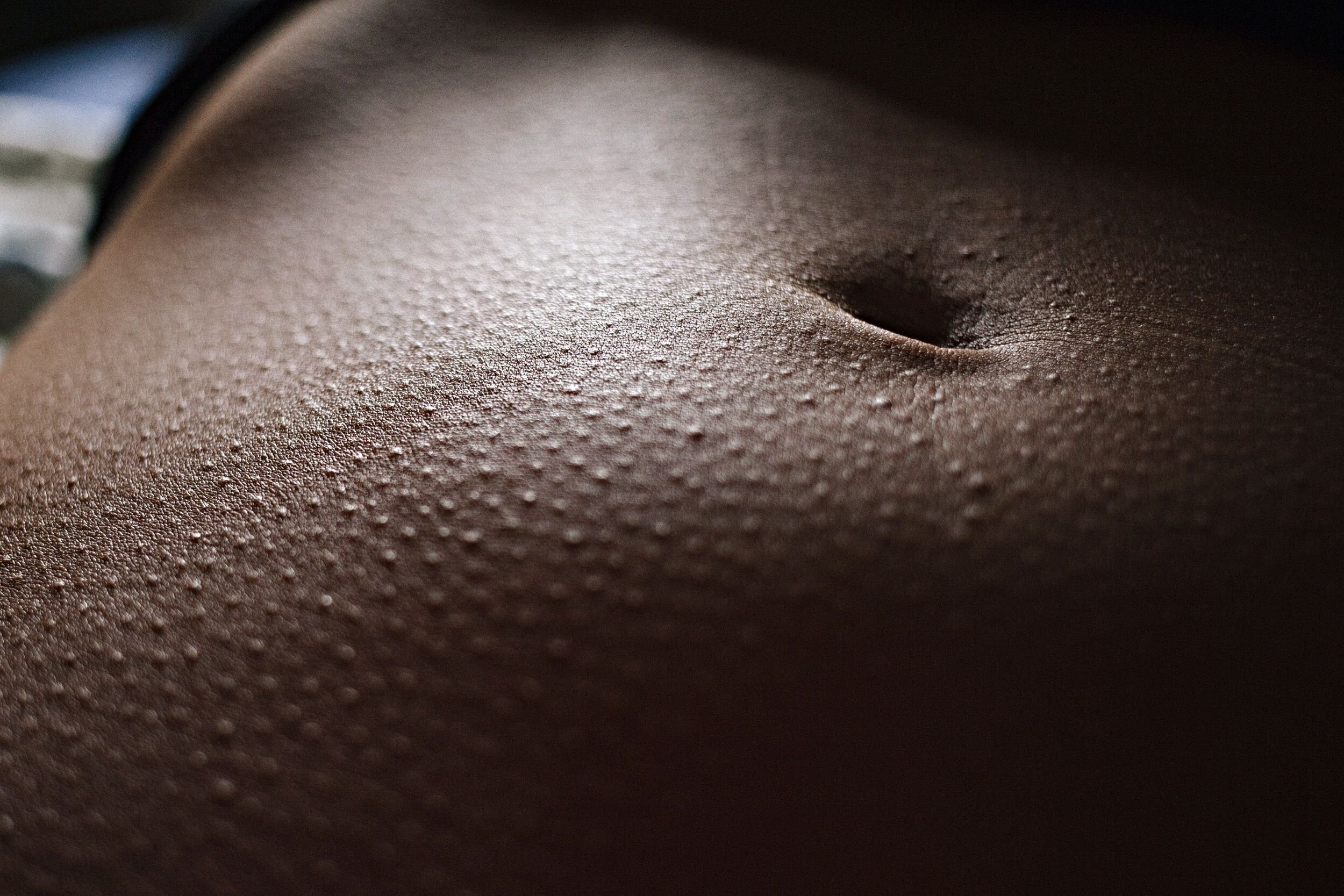 Up close 3. Фолликулярный Каритас. Женское тело в мурашках. Мурашки на коже.
