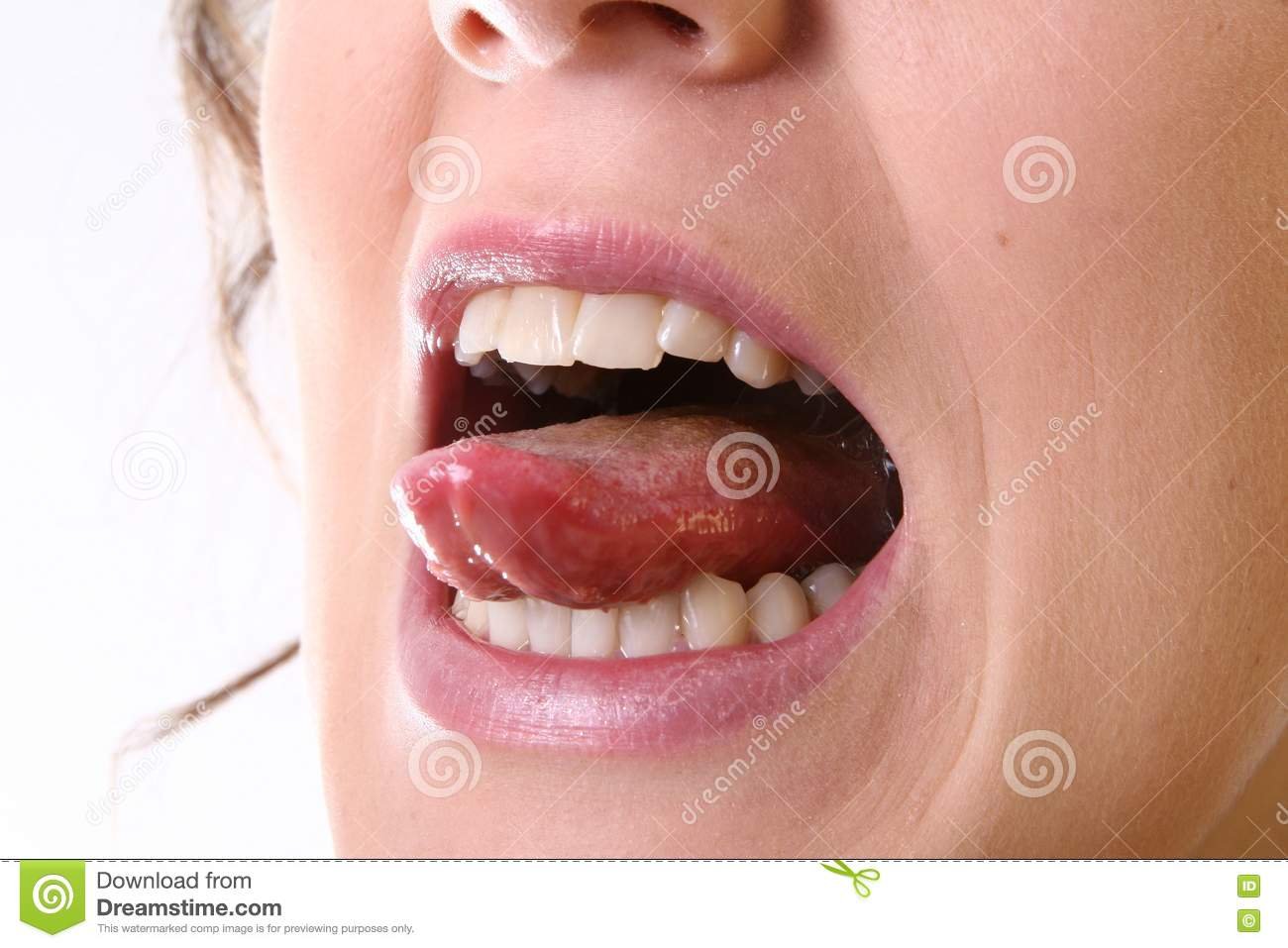 Под языком воспаление на кончике языка