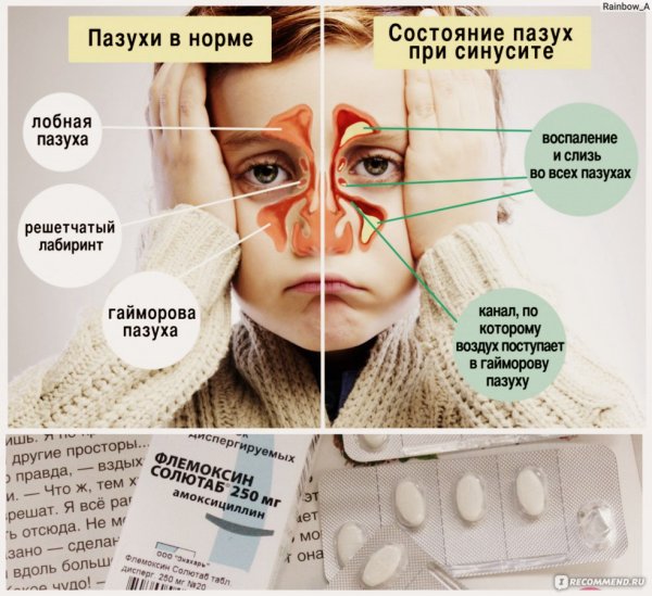 Я вся горю прикол