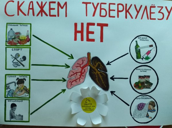 Туберкулез плакат