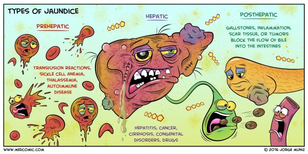 Types of jaundice