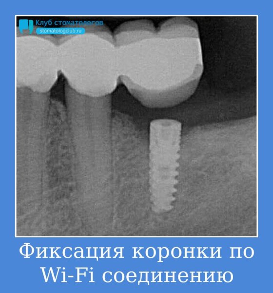 Очень смешные демотиваторы черный юмор