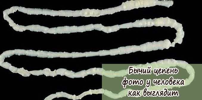 Бычий цепень картинка
