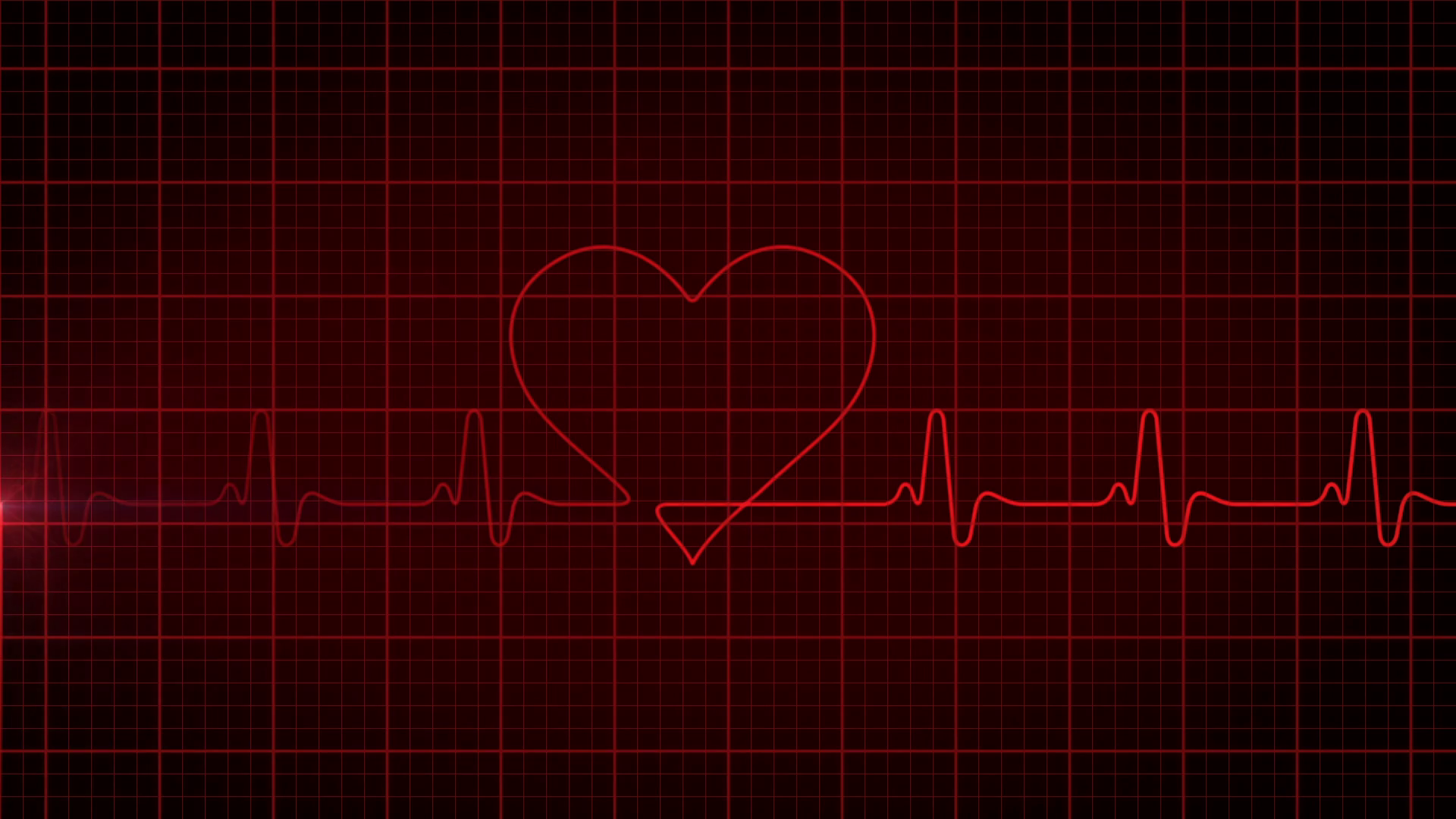 Сердцебиение девушки. Кардиограмма здорового сердца. Пульс сердца. Обои пульс. Биение сердца на черном фоне.