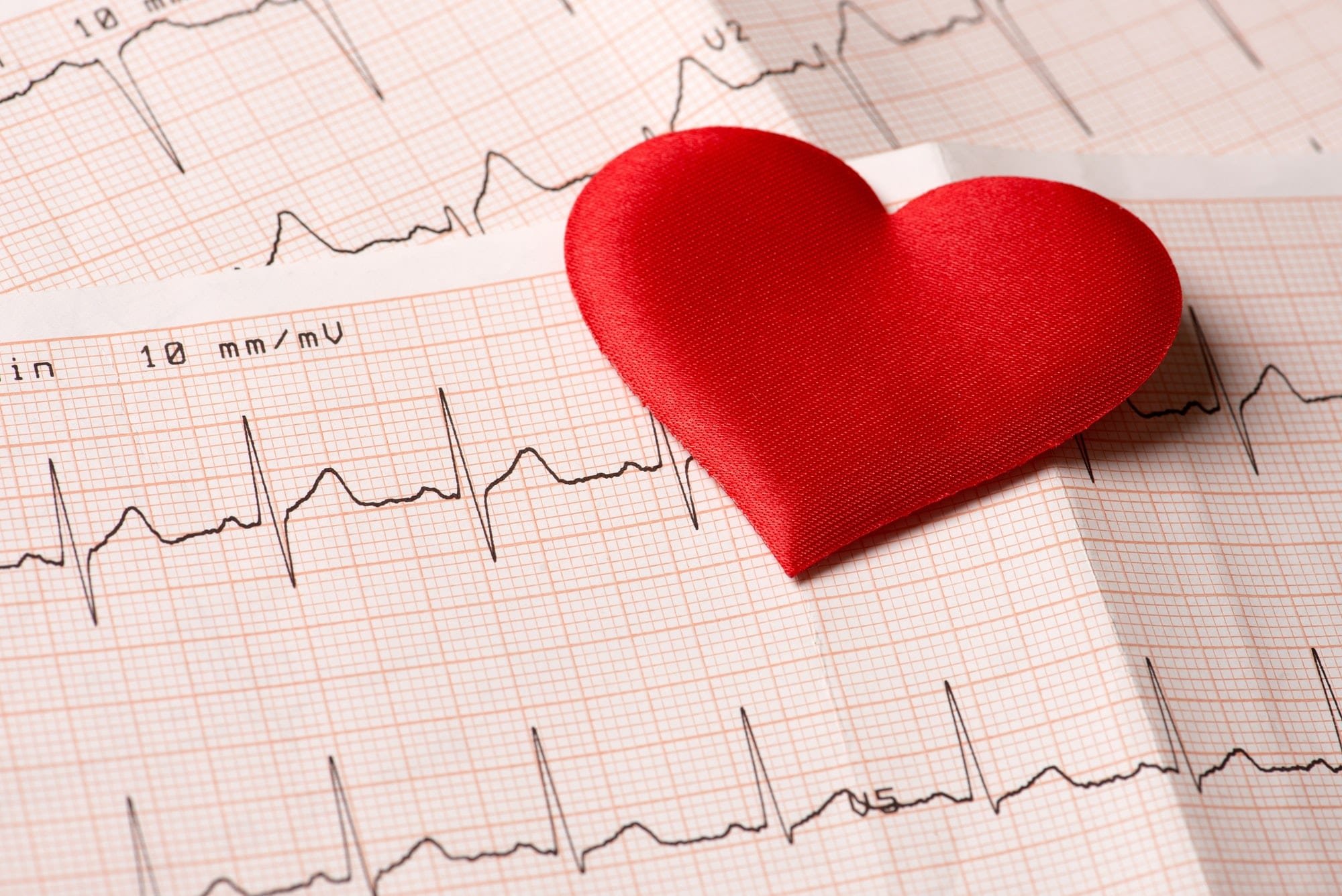 Экг. Здоровье сердца. Кардиология рисунок. Кардиология ЭКГ. Диаграмма сердца.