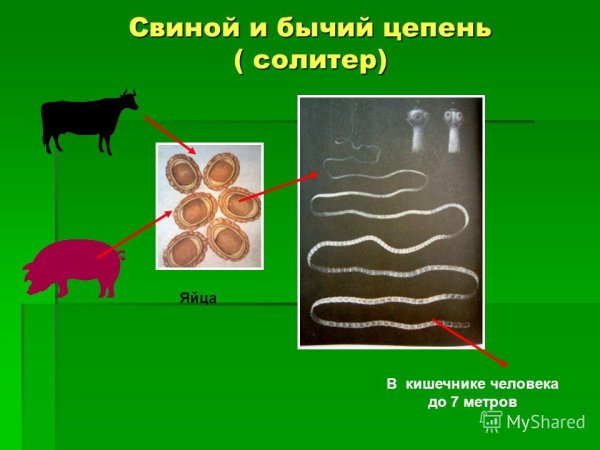 Цепень бычий и свиной (Солитер)
