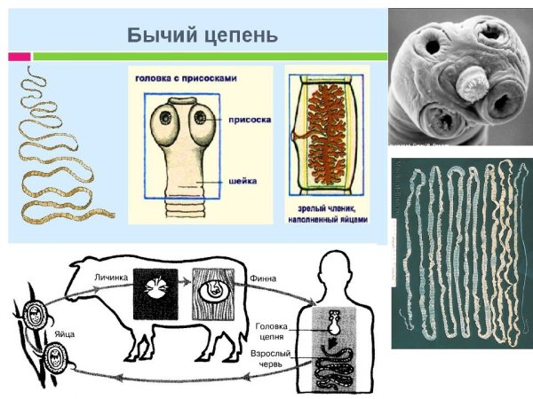 Строение финны свиного цепня
