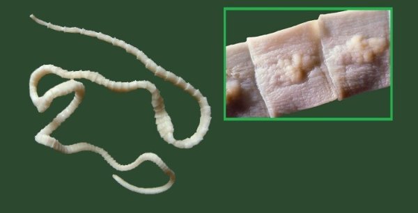 Ленточные черви широкий лентец