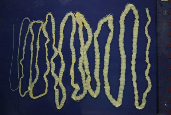 Ленточные черви бычий цепень